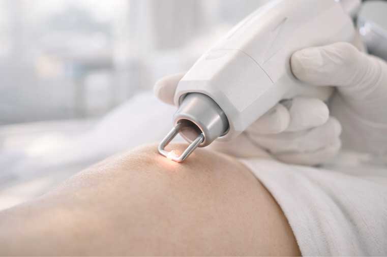 Laser consultation